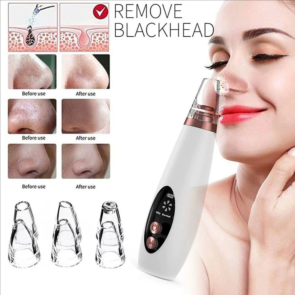 Electric Pore Blackhead Removal Vacuum Cleanser Acne Removal Blackhead Remover Facial Pore Cleaner Machine Beauty Skin Care