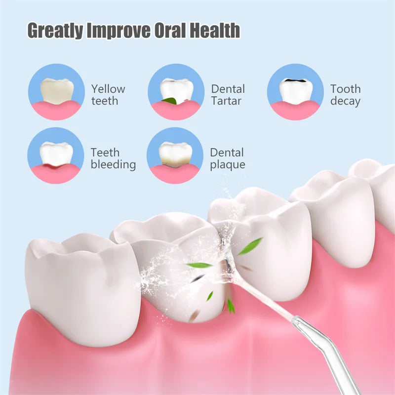 Oral Irrigator kit Portable Dental Water Flosser USB Rechargeable Water Jet Floss Tooth Pick 4 Tip 220ml 3 Modes IPX7 1400rpm